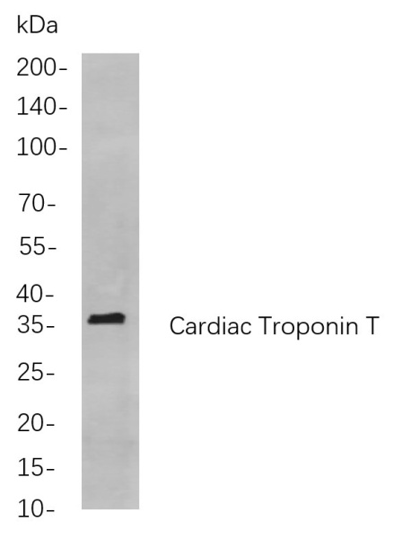 Recombinant Cardiac Troponin T Monoclonal Antibody (AN300897L)