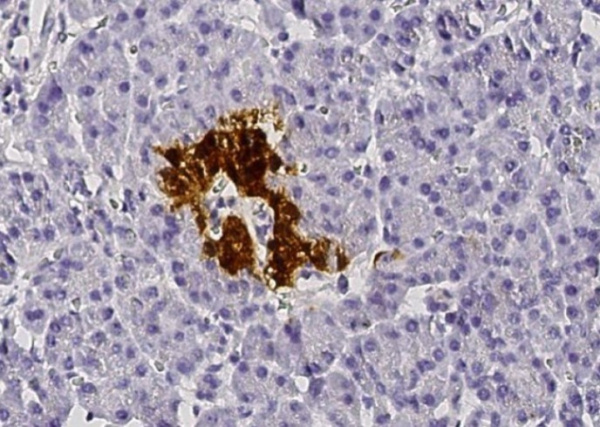 SCGN/Secretagogin Monoclonal Antibody (AN200130P)