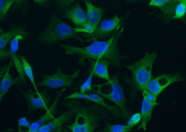 Doublecortin/DCX Monoclonal Antibody (AN200080P)