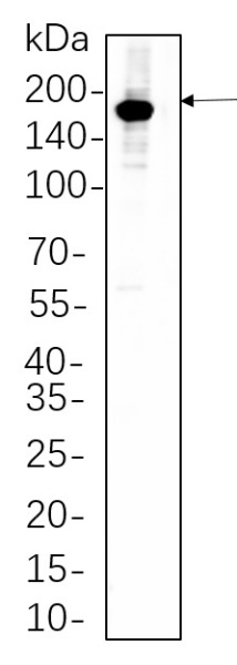 Recombinant HER2 Monoclonal Antibody (AN300730L)
