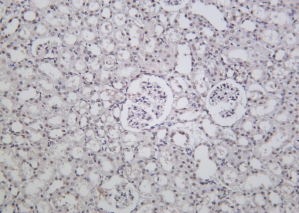 Recombinant BRD4 Monoclonal Antibody (AN301189L)