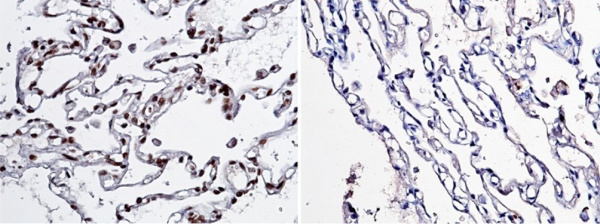 NBL1/DAND1/DAN Monoclonal Antibody (AN200095P)
