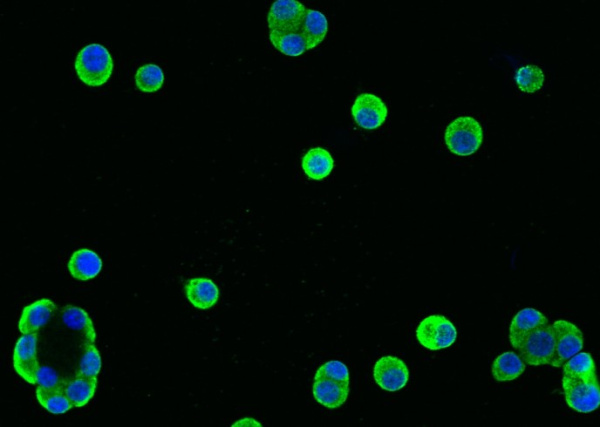 REG1A Monoclonal Antibody (AN200210P)
