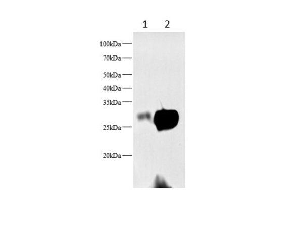 STAR Polyclonal Antibody (AN007300L)