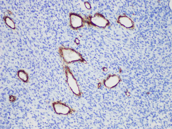 CD146 Monoclonal Antibody (ELAB6956-R)