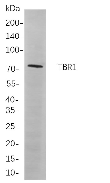 Recombinant TBR1 Monoclonal Antibody (AN301110L)