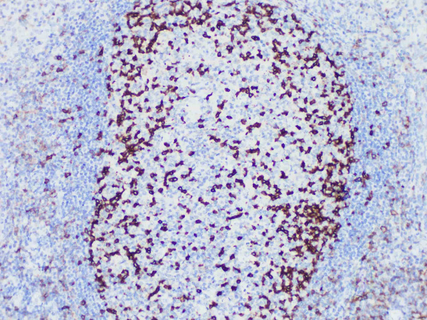 PD-1 Monoclonal Antibody (ELAB6084-M)