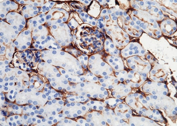 Recombinant ICAM-1/CD54 Monoclonal Antibody (AN300518P)