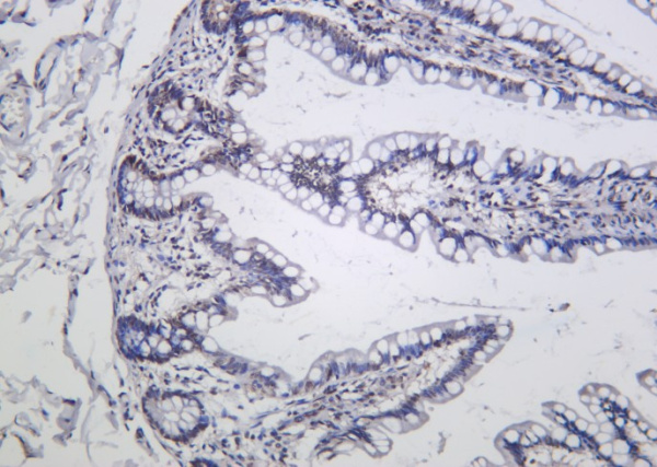 Recombinant Phospho-IκB-α (Ser36) Monoclonal Antibody (AN301280L)