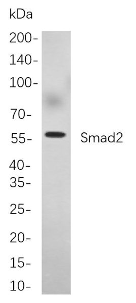 Recombinant Smad2 Monoclonal Antibody (AN301013L)