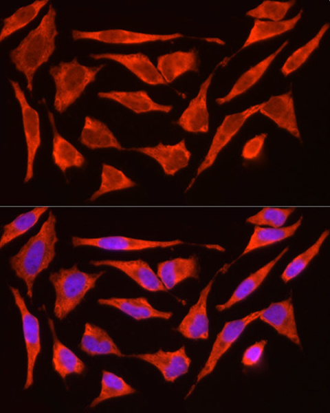 POMC Polyclonal Antibody (E-AB-92506)