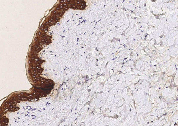 Recombinant KRT5 Monoclonal Antibody (AN300109P)