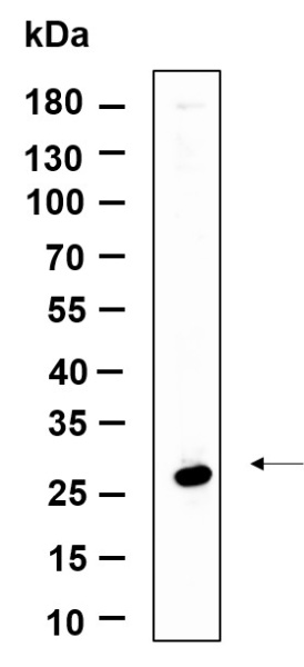 Recombinant NAG-2 Monoclonal Antibody (AN301215L)