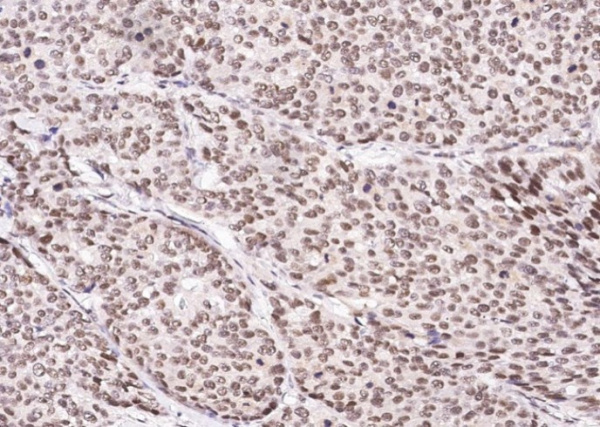 Recombinant CUEDC2 Monoclonal Antibody (AN300233P)