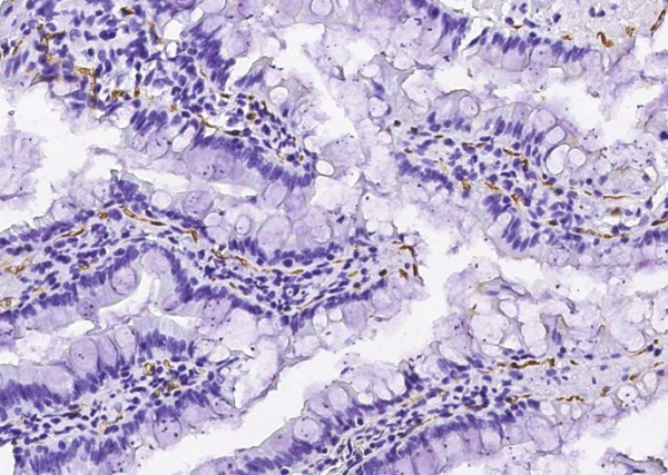 Recombinant CD36/SCARB3 Monoclonal Antibody (AN300588P)