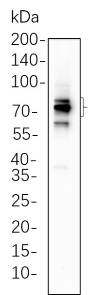 Recombinant FOXP1 Monoclonal Antibody (AN300612L)