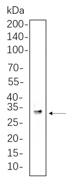 Recombinant SDHB Monoclonal Antibody (AN301365L)