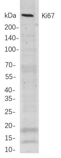 Recombinant Ki67 Monoclonal Antibody (AN301074L)
