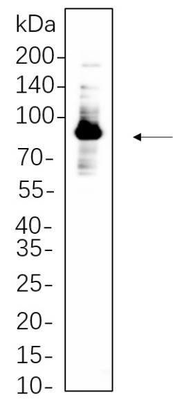 Recombinant Glycogen Synthase Monoclonal Antibody (AN300818L)