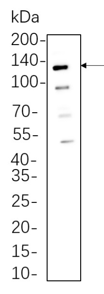 Recombinant Axl Monoclonal Antibody (AN300623L)