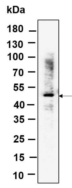 Recombinant RGS6 Monoclonal Antibody (AN301234L)