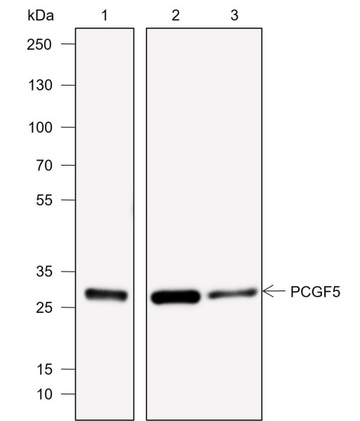 Recombinant PCGF5 Monoclonal Antibody (AN302045L)
