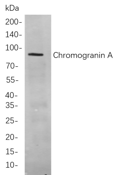 Recombinant Chromogranin A Monoclonal Antibody (AN300989L)