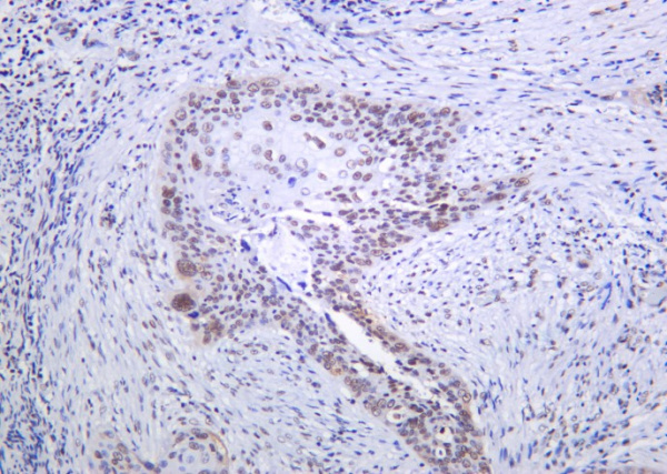 Recombinant SRSF2 Monoclonal Antibody (AN301275L)