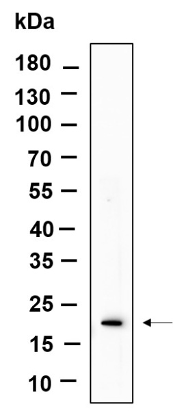 Recombinant Phospho-Histone H3 (Ser10, Thr11) Monoclonal Antibody (AN301136L)