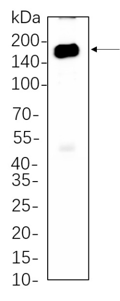 Recombinant HDAC6 Monoclonal Antibody (AN301313L)