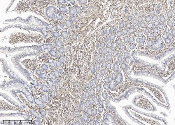Recombinant Vimentin Monoclonal Antibody (AN300290P)