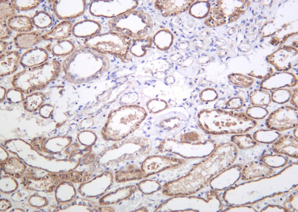 Recombinant Phospho-eNOS (Ser1177) Monoclonal Antibody (AN301244L)