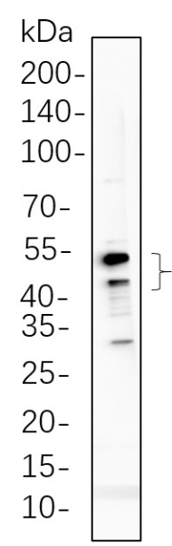 Recombinant Phospho-GSK3 α, β (Tyr216, Tyr279) Monoclonal Antibody (AN300656L)