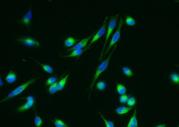 Recombinant Nicastrin/NCSTN Monoclonal Antibody (AN300390P)