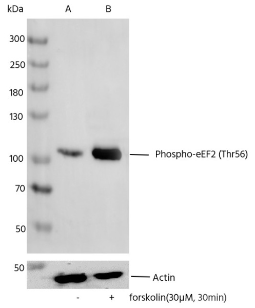 Recombinant Phospho-eEF2 (Thr56) Monoclonal Antibody (AN300155L)