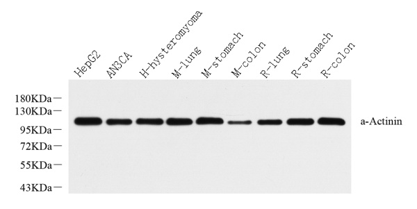 ACTN1 Polyclonal Antibody (E-AB-70225)