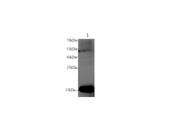 GSTM1 Polyclonal Antibody (D-AB-10378L)