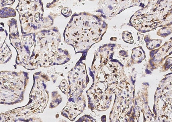Recombinant SOD2 Monoclonal Antibody (AN300261P)