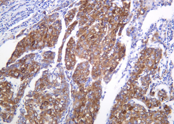 Recombinant Shh Monoclonal Antibody (AN301249L)