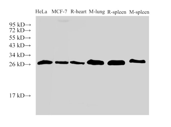 Galectin 3 Polyclonal Antibody (E-AB-40380)