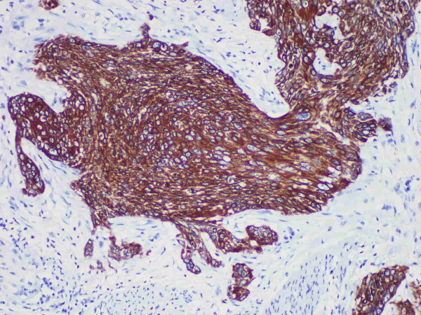 CK-HMW（34betaE12） Monoclonal Antibody (ELAB6905-R)