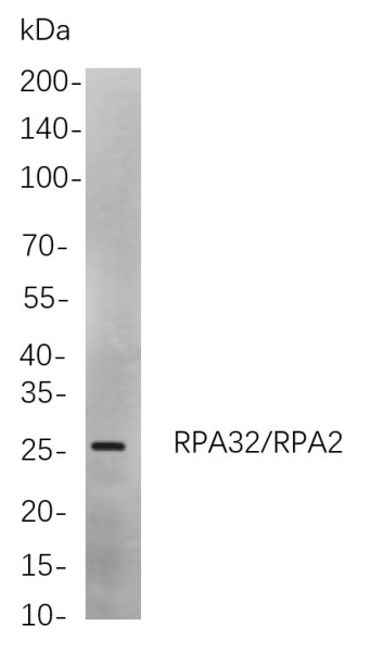 Recombinant RPA32/RPA2 Monoclonal Antibody (AN300951L)