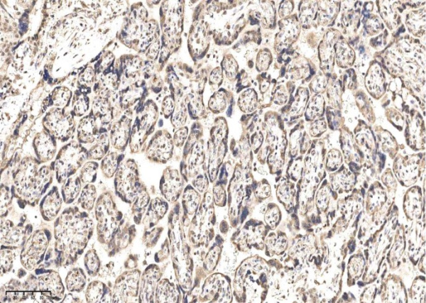 IGSF3 Monoclonal Antibody (AN200212P)