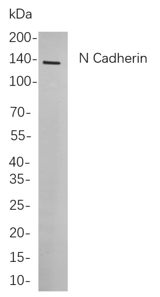Recombinant N Cadherin Monoclonal Antibody (AN300983L)