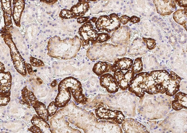 KSP-Cadherin/Cadherin-16 Monoclonal Antibody (AN200195P)