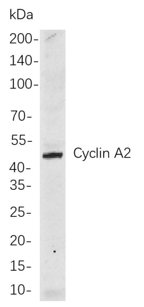 Recombinant Cyclin A2 Monoclonal Antibody (AN300952L)
