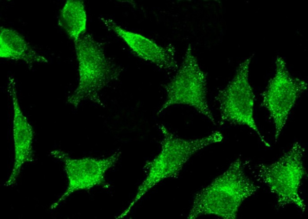 Recombinant IFI30 Monoclonal Antibody (AN300259P)