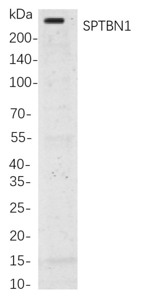 Recombinant SPTBN1 Monoclonal Antibody (AN300880L)