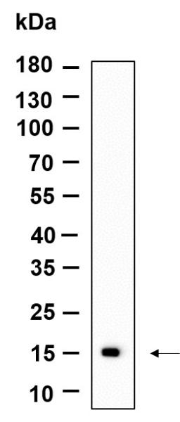 Recombinant CLEC2B Monoclonal Antibody (AN301235L)