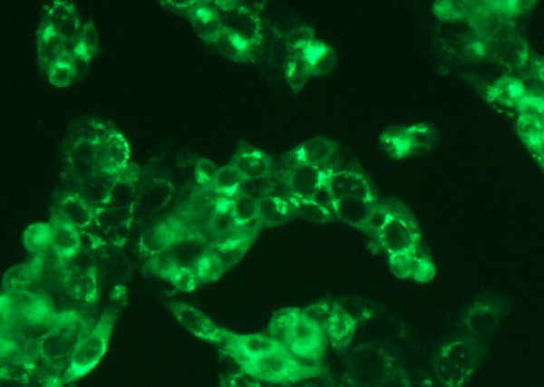 Recombinant Human Serum Albumin/HSA/ALB Monoclonal Antibody (AN300577P)